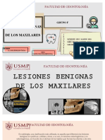 Lesiones Benignas de Los Maxilares - Radiologia - Grupo F