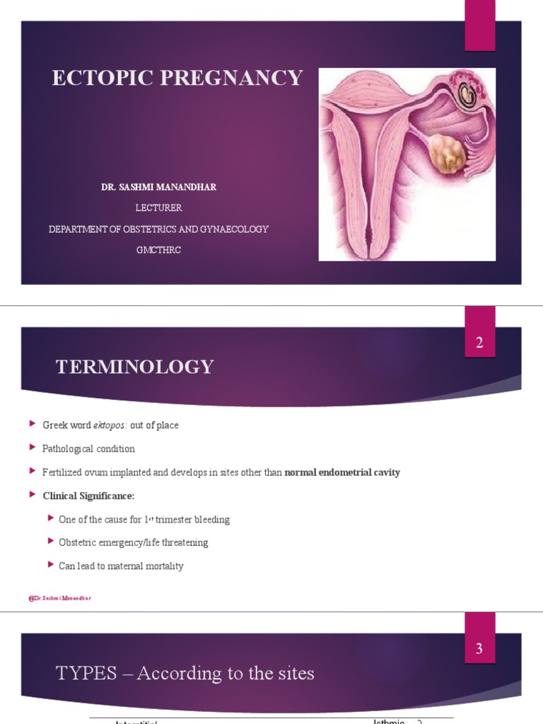 An In-Depth Review of Ectopic Pregnancy: Risk Factors, Diagnosis