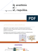Tipos de Anestesia Regional