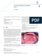 Post Insertion Problems in Complete Dentures