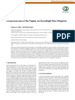 Case Report: Leiomyosarcoma of The Vagina: An Exceedingly Rare Diagnosis