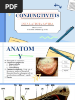 Conjunctivitis - Dita LS