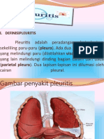 Penyakit Pluritis