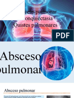 Absceso Pulmonar, Bronc