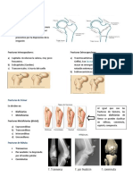 Fracturas de Extremidad Inferior