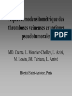 Aspect tomodensitométrique des thromboses veineuses cruoriques pseudotumorales 