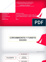 Corioamnionitis y Funisitis