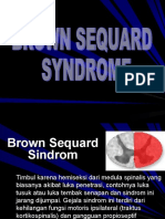 Brown Sequard Syndrome (BSS)