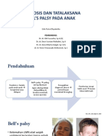 Bell's Palsy Pada Anak