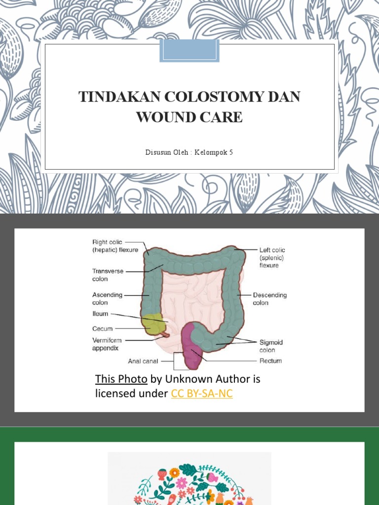 Tindakan Colostomy Dan Wound Care Pdf