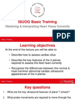 ISUOG Basic Training: Obtaining & Interpreting Heart Views Correctly