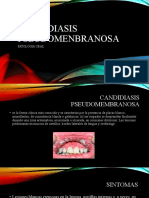 Candidiasis Pseudomembranosa