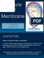 Rupture OF Membrane: Done By: Toqa Omar