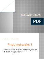 Presentasi Pneumotoraks