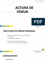 Fractura de Fémur