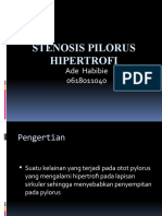 PTT Stenosis Pilorus