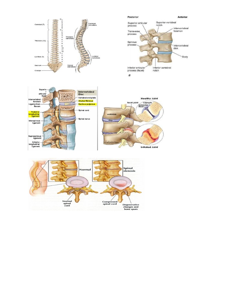 Gambar Lumbal Normal Dan Bermasalah | PDF