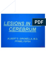 Lesion in Cerebrum