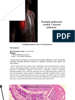 2__Patologia_pulmonară_cronică__Cancerul_pulmonar_-34508