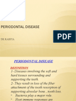 Periodontal Disease: DR Rabiya