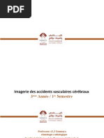 02- Imagerie Des AVC