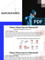 Hipospadia