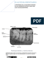 Estructuras del complejo alveolodental