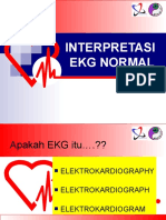 Ekg Normal