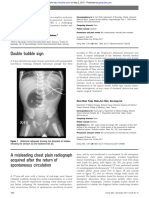 Double Bubble Sign: Images in Emergency Medicine