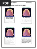 Regla de Applegate | PDF | Dentadura postiza | Ramas de Odontología