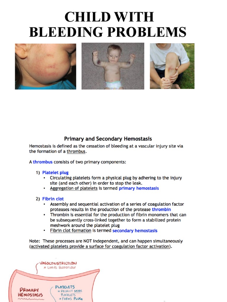 Evaluating Bleeding Disorders in Children | PDF | Coagulation | Haemophilia