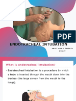 Endotracheal Intubation: Angel Ann G. Talento Bsn-Iv