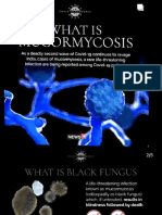 What Is: Mucormycosis