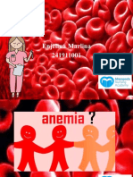 Anemia