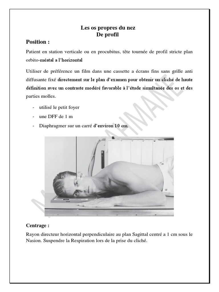 Les Os Propres Du Nez (Cours13) | PDF