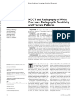 MDCT and Radiography of Wrist Fractures: Radiographic Sensitivity and Fracture Patterns