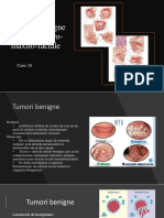 Tumori benigne si maligne oro-maxilo-faciale curs 10