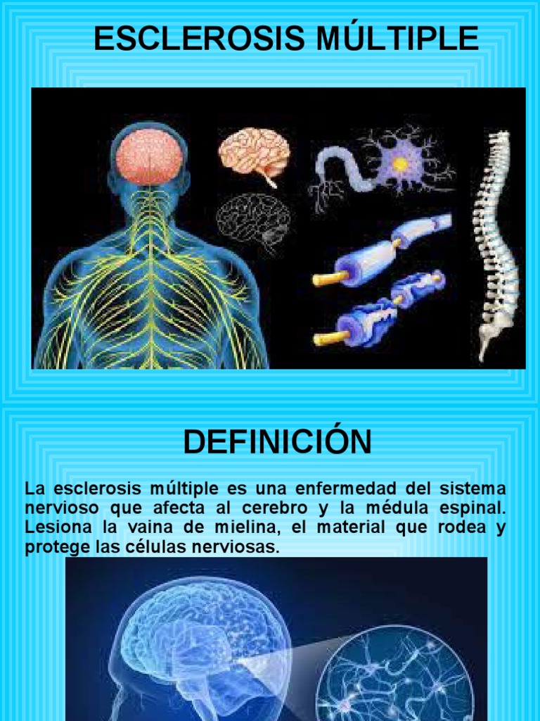 Esclerosis Múltiple | PDF | Esclerosis múltiple | Sistema nervioso