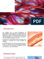 Vasculitis 2