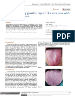 Benign Migratory Glossitis Report of A Rare Case With Review of Literature
