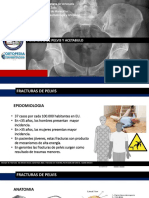 Fracturas de Pelvis y Acetabulo