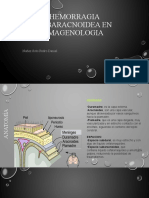 Hemorragia Subaracnoidea en Imagenologia