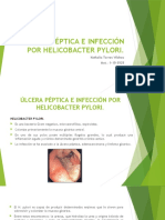 Úlcera Péptica e Infección Por Helicobacter Pylori