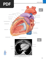 Netter Corazon | PDF | Ventrículo (corazón) | Corazón