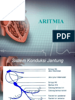Presentasi Aritmia
