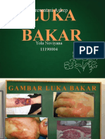 presentasi_tentang_LUKA_BAKAR