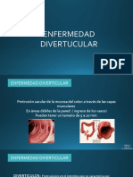 Enfermedad Diverticular