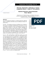 Stimulus Deprivation Amblyopia in Human