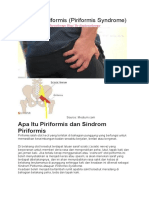 Sindrom Piriformis (Piriformis Syndrome)
