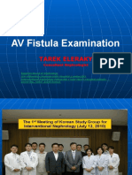 AV Fistula Examination: Tarek Eleraky